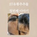 [엘램] S7유황추출물 사용 후기 - 20대 여성 헤어 라인 탈모