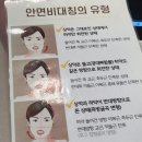 [청담역 턱관절 한의원] 얼굴비대칭 고민? 턱관절 교정 받고 오다!