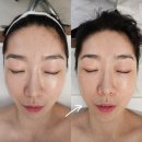 해운대 중동 스위첸 | 해운대에스테틱 피부관리와 작은얼굴 관리 만족 후기, 윤권희피부연구소