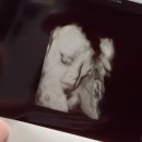 일로평안 | 임신기록 : 우당탕탕 평안할 일 없는 임신후기 전북 신생아 진료 붕괴