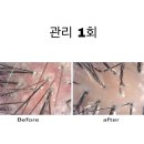 관리 1회로 효과 보는 클레르두피케어센터