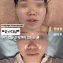 도봉로3길-5 | 구미 윤곽관리 잘하는 곳✨ 영바디샵 후기 (광대·턱선 변화 실화?)