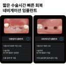 대화역치과 임플란트 잘하는 곳 체크하는 법