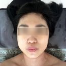 약초이야기 | 청주피부관리 찾는다면｜가경동 보라뷰티 약초필링 받고 피부결 달라진 후기