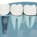 수로왕릉역 이미지