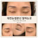 서구-26 | 대전 서구 눈썹문신 오래된 붉은 잔흔을 정리한 후기