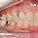 수원탑플란트치과의원 이미지