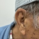 광주크리닝마트 | 80대 아버님, 보청기 착용 1년 후 정기점검 방문