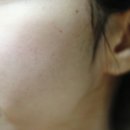 핌플하우스 | 교대 피부관리 | <핌플하우스>에서 트러블피부관리했어요