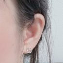 팅커벨 | 팅커벨필러 후기, 귀필러 맞고 유지기간 및 리터칭