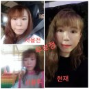 라온인셀덤 - 포항시 남구 | [공지]인셀덤후기 리프팅시술No 탄력관리하고싶은분들 들어오세요!!!