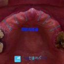 서울민플러스치과 이미지