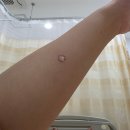 김포/조은미래 세번째 제왕절개 후기와 젖몸살