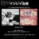 홈플란트치과의원 이미지