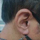 프리미엄보청기 계양센터 이미지