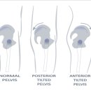 허리편한의원 이미지