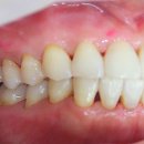 바이오크리닝 이미지