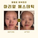 [영등포역 피부관리_마리앙 에스테틱] 연결된 근육 다 풀어주는 윤곽관리 솔직 후기