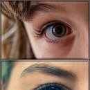 푸른하늘안과의원 | 반짝이는 눈 건강! 초간단 눈 운동 &amp; 꿀팁 대방출