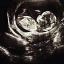 은산부인과의원 이미지