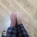 대림정형외과의원 | 발목 골절후 재활 2주 차 물리치료 후기