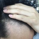 교래 말 전문병원 | 탈모 병원 추천