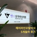 헤어로의원 | 밴스모자이너의원 여자헤어라인모발이식 수술 후기ㅣ회복속도, 통증, 생착 과정 공유!