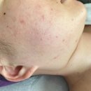 달콤네일/스킨스토리 이미지