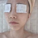 693 | 갈마동피부관리 잘하는곳 끌밋에서 스킨디톡스 솔직후기
