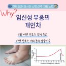 민산부인과의원 | 왜 임신중 어떤 산모는 많이 붓고 어떤 산모는 거의 붓지 않을까?