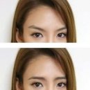 동안피부관리실 네이버블로그