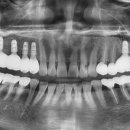 이건치과기공소 이미지