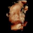 아진약국 | 만두빚기기록 - 임신 25주 ~ 임신32주