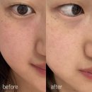 뉴타입의원 | [속건조필수템 추천] 피부장벽강화 &amp; 약산성보습 고보습크림, 뉴스템 알엑스 모이스딥 크림 사용 후기