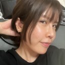 베이비멍 | 신사역 피부과 얼굴 실리프팅 후기 베이비리프팅 효과 부작용 딤플 멍 알아보자