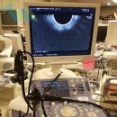 Olympus GF-UCT240 Endoscopic Gastroscope 이미지