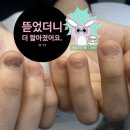 강동-천호-2821 | 천호동 중학생 물어뜯는 손톱 연장｜3회차 방문 후기