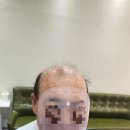 여성헤어(커트부터 염색,파마까지)(야) | [송파남자가발] 분당에서 찾아온 70대, 가발파마+가발커트로 완벽 스타일링 석촌역 가발전문미용실 미미...