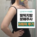 신사세탁 | 신사 팔뚝지방분해주사 효과 6회차 후기 | 다이어트 주사 (조각주사)