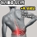 혜성정형외과 앞 | 허리통증이 있다면 병원가기 전에 꼭 보세요!(허리디스크 협착증이 있다면)