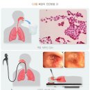 22년간 한국철도공사 기관사로 근무한 망인이 비소세포성 폐암으로 사망하여 그 배우자인 원고가 유족급여를 청구한 사안 이미지