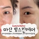 마산회원구 ⓓ-10 | 마산피부관리실 내서 밍스킨케어 VVS다이아몬드필 후기