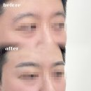 [원주] 남자눈썹 문신 고민 중? 디자인 잘 잡는 인블리 추천해요!!