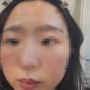 피카브로우 이미지