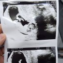 강문정 산부인과의원 이미지