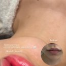 더뮤어 이미지