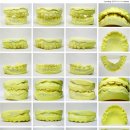 바른치과기공소 이미지