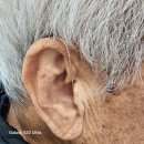 대동 독일보청기 이미지