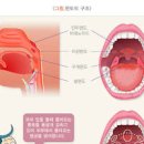 인후염 편도염 증상 차이 줄이는 방법 이미지