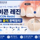 뉴욕바른라인치과의원 | 약수역치과, 아이콘레진의 원리와 치료과정